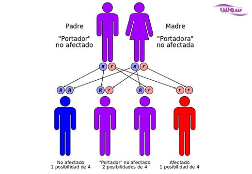 فنیل کتونوریا (Phenylketonuria)