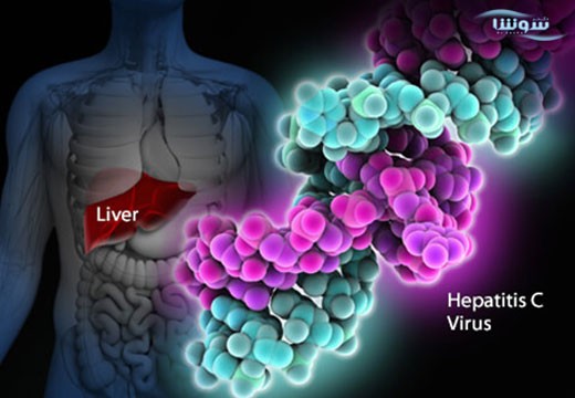 هپاتیت Hepatitis C | C