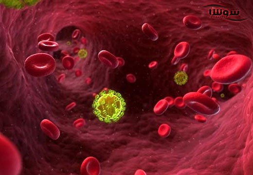 عفونت HIV یا ایدز (AIDS )