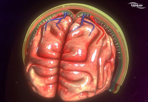 مننژیت (meningitis)