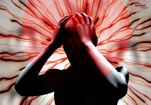 میگرن (Migraine)