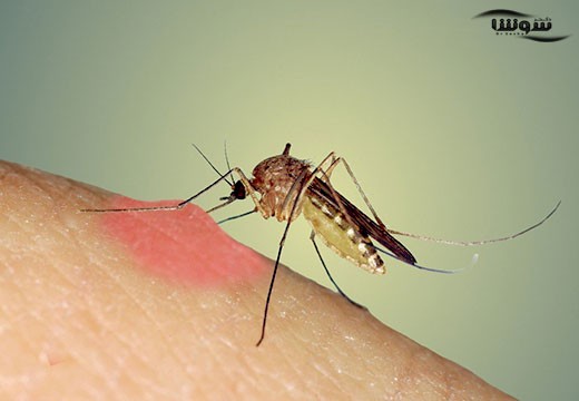نیش حشرات (mosquito-bites)