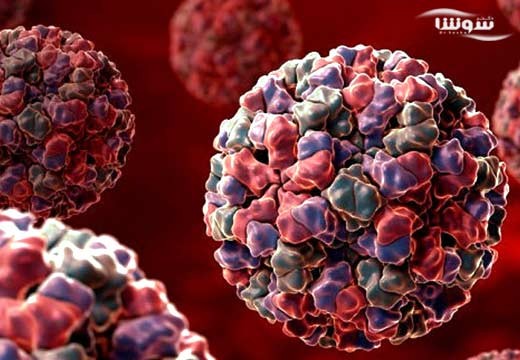 عفونت نوروویروس (Neurovirus infection)