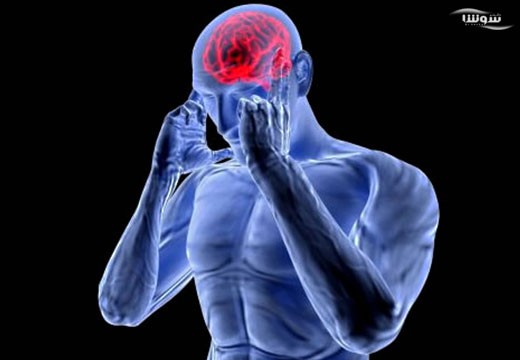 سردردهای تنشی (tension headache)