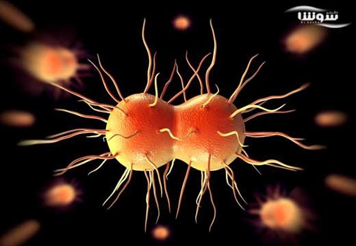 سوزاک (Gonorrhea)