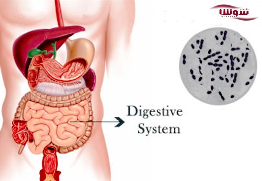 تب مالت | بروسلوزیس (Brucellosis)