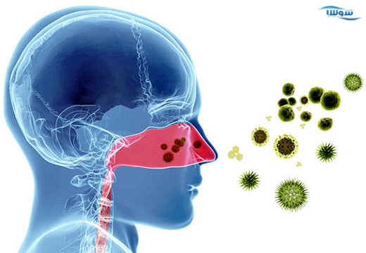 تب یونجه (Hay fever)