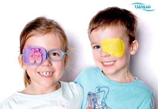 تنبلی چشم (amblyopia)