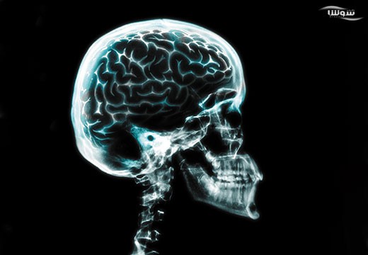 اختلال اضطراب منتشر (Generalized anxiety disorder)
