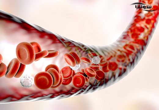 هموفیلی (Hemophilia)