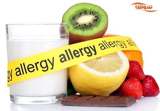 آلرژی غذایی (food allergy)