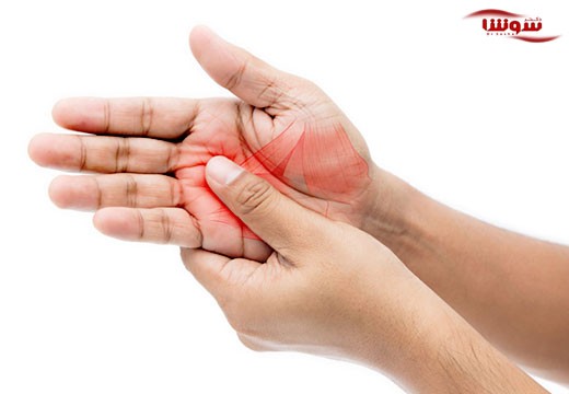 بیحسی (Numbness)