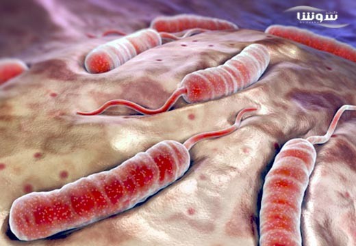 وبا (cholera)