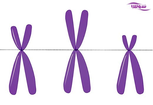 آگاماگلوبولینمی وابسته به X-LINKED AGAMMAGLOBULINEMIA) X)