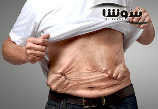 مهمترین گیاهان دارویی ضد سرطان معده