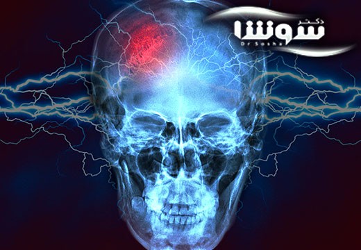 بیماری صرع | غذا هاي مفيد براي کاهش حملات صرع