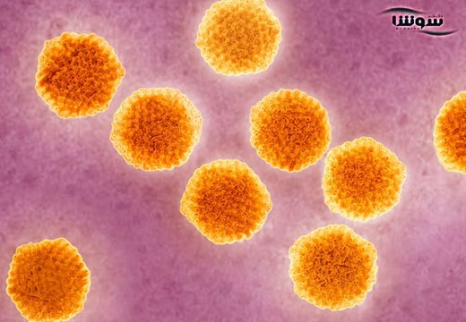هپاتیت Hepatitis A | A