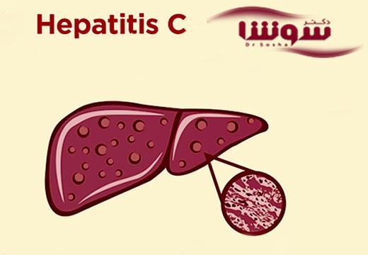 با خستگی ناشی از بیماری هپاتیت C چهکار کنیم؟