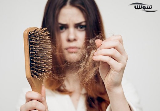 ریزش مو (Hair loss)