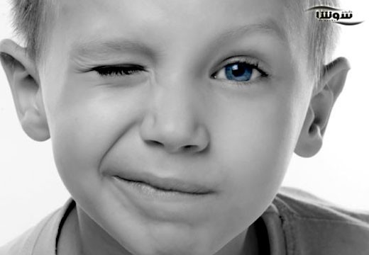 اختلالات تیک (Tic disorder)