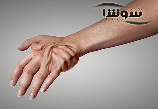 چگونه درد روماتیسم مفصلی را کم کنیم؟
