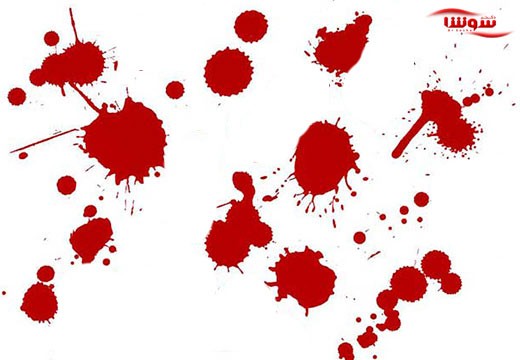 لکه بینی بین قاعدگی | خونریزی واژینال (Vaginal bleeding)