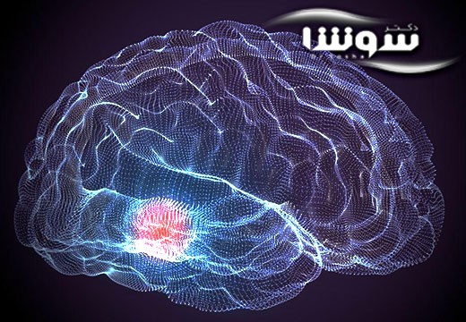 بیماری پارکینسون | 6 نکته درباره بیماری پارکینسون