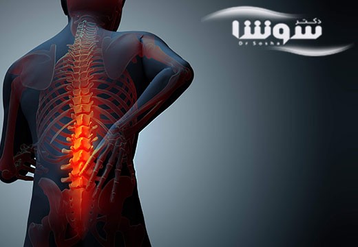 بیماری پوکی استخوان را چگونه تشخیص بدهیم