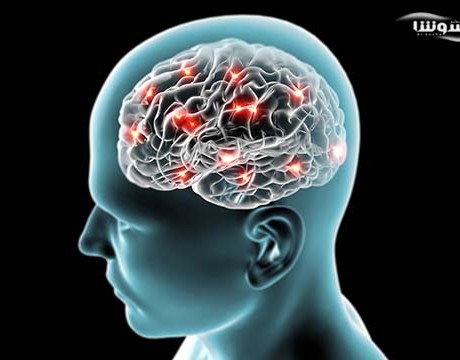باکتری در مغز افراد آلزایمری بیشتر وجود دارد