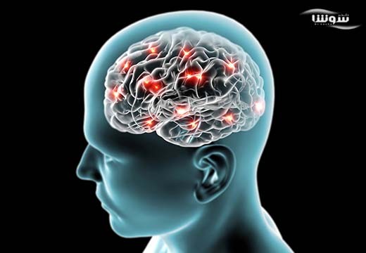 باکتری در مغز افراد آلزایمری بیشتر وجود دارد