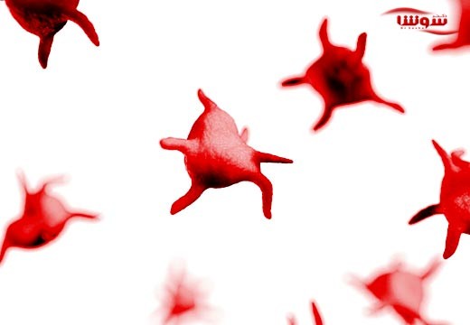 ترومبوسیتوپنی (Thrombocytopenia)