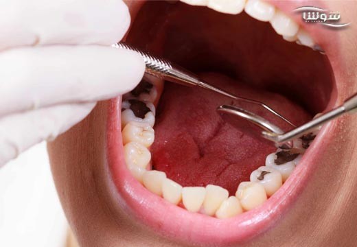 رویش مجدد دندان ها با آسپرین