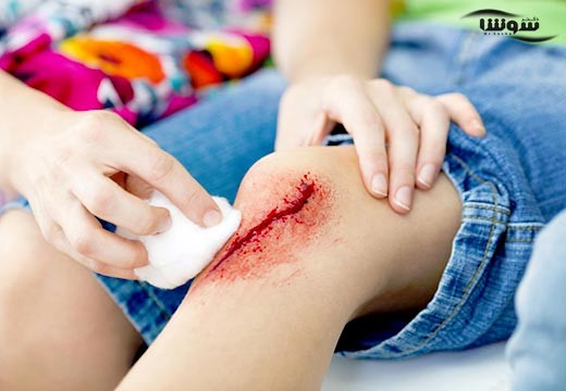 اختراع باند الکترونیکی برای درمان زخم های مزمن