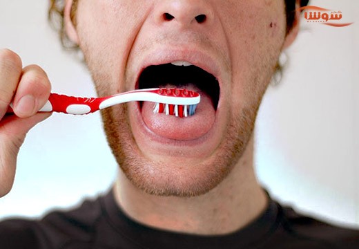 بوی بد دهان | هالیتوز ( Halitosis | Bad breath )
