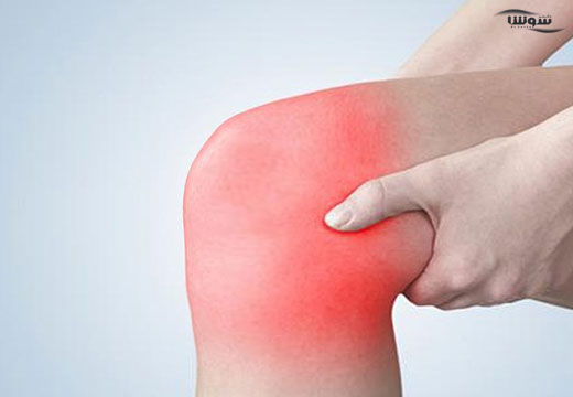 آب آوردن زانو (Swollen-knee) آب آوردن زانو (Swollen-knee)