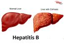 هپاتیت Hepatitis B | B