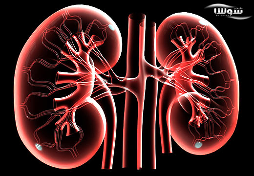 10 راهکار پیشگیری از بیماری کلیوی 10 راهکار پیشگیری از بیماری کلیوی