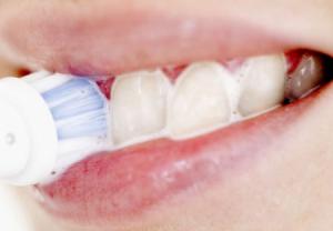 زردی دندان را چگونه از بین ببریم