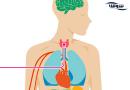 کم کاری تیروئید | هیپوتیروئیدی  (Hypothyroidism)