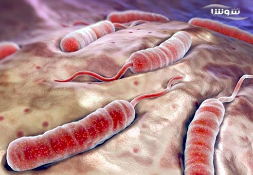 وبا (cholera) وبا (cholera)