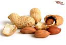 آلرژی به بادام زمینی (Peanut allergy)