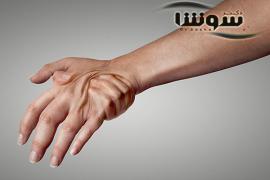 چگونه درد روماتیسم مفصلی را کم کنیم؟