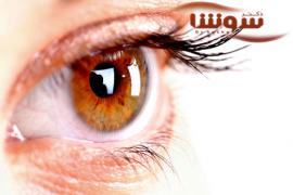 رایج‌ترین بیماری و عارضه های چشمی را بشناسید