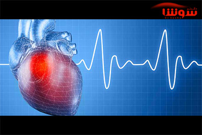 ویدیو پیش بینی سکته قلبی از یکماه جلوتر ویدیو پیش بینی سکته قلبی از یکماه جلوتر
