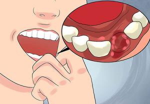 توصیه دندان‌پزشکان برای خوردن بستنی چیست