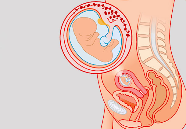 علائم و وضعیت زن باردار در هفته دوازدهم بارداری