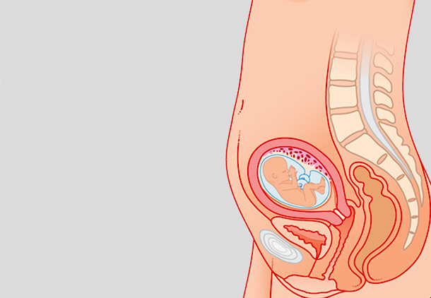 علائم و نشانه‌های هفته هفدهم بارداری