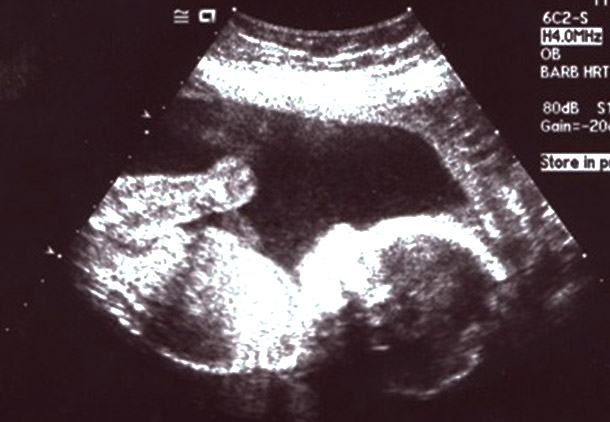 اندازه جنین در هفته نوزدهم بارداری