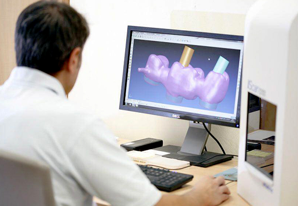تصویربرداری داخل دهانی و کد/کم (CAD/CAM) 