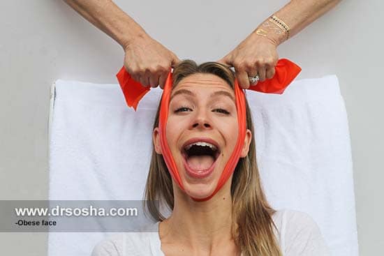 چاق شدن صورت در یک هفته نکات کاربردی و مفید چاق شدن صورت در یک هفته نکات کاربردی و مفید